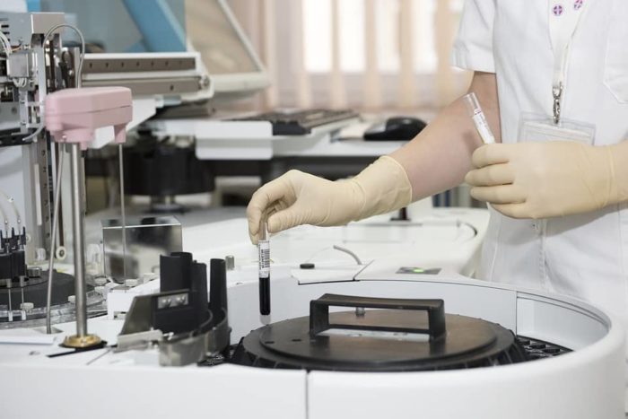 Diagnose von Elektrosensibilität in einem Labor